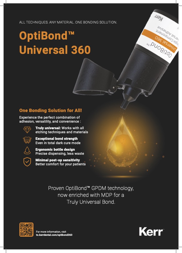 MKT-25-0404_OptiBond360-ADV-black-drop