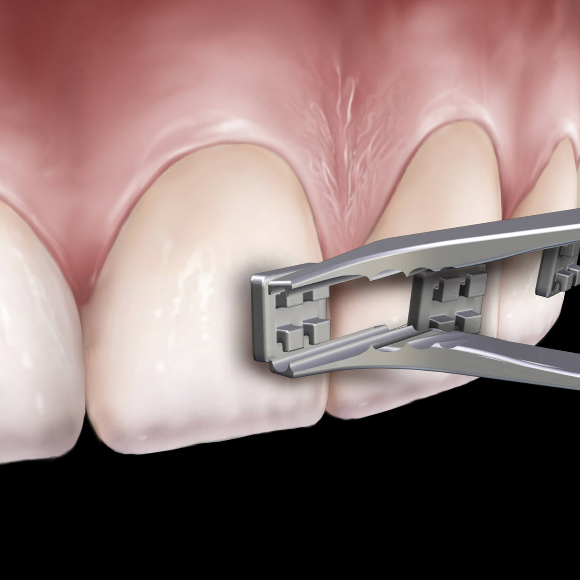 678-504__678-504-clinical-illustration_rgb